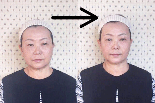 Tさんビフォーアフター比較写真.線無し.png