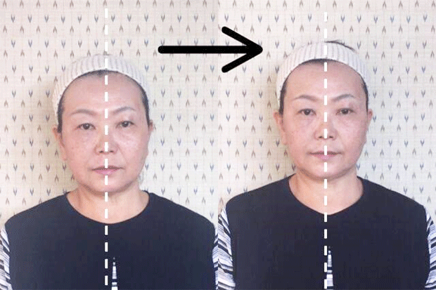 Tさんビフォーアフター比較写真