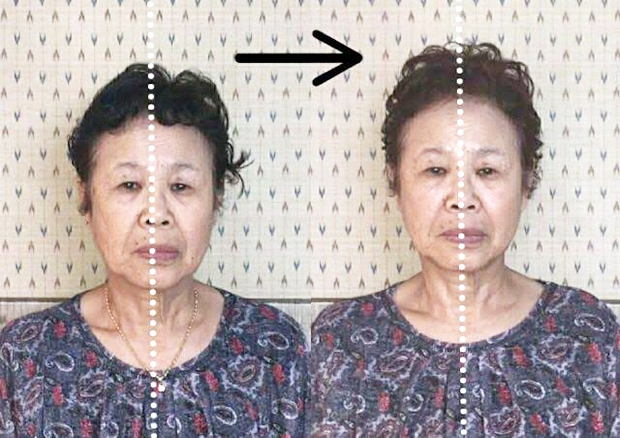ビフォーアフター症例写真集