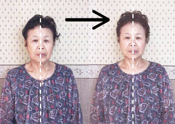 ビフォーアフター症例写真1