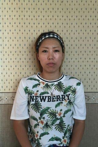 モニター様歪み施術前9月4日.jpg